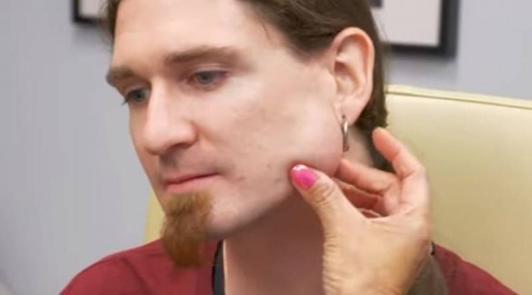 ‘Dr. Pimple Popper’: Kevin With The ‘Jaw-Breaker’ Bump Passes Away