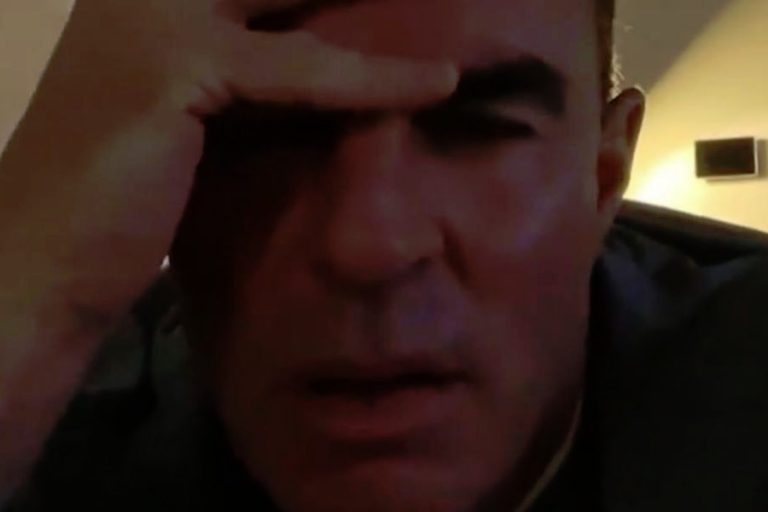 ‘RHOC’ Alum Jim Edmonds Needs 12 Stitches After Accident At Home