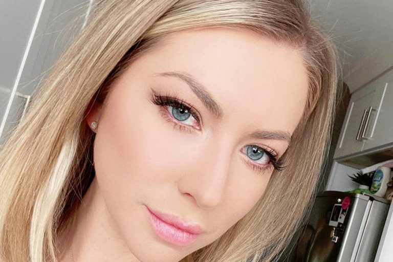 ‘VPR’: Stassi Schroeder Gets Real, Posts Photo Showing Roots And Psoriasis
