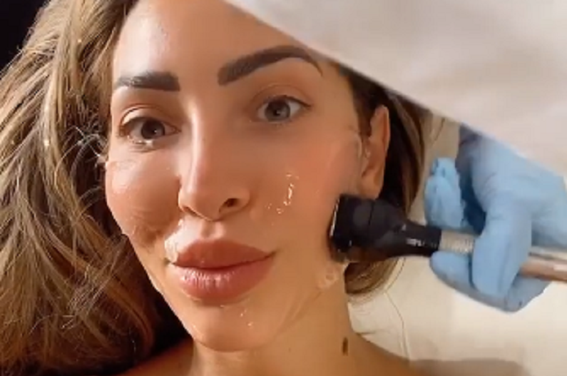 Farrah Abraham Concerns Followers With Her Latest Skin Treatment