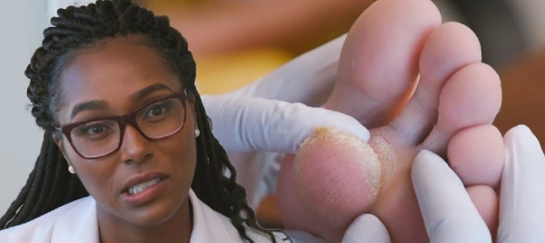 TLC’s First Look At ‘My Feet Are Killing Me’ Leaves Viewers Disturbed