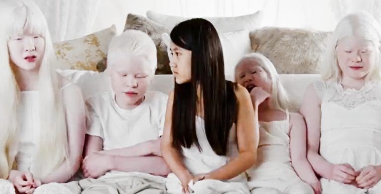 Grabowski Kids, Born with Albinism, Still TLC