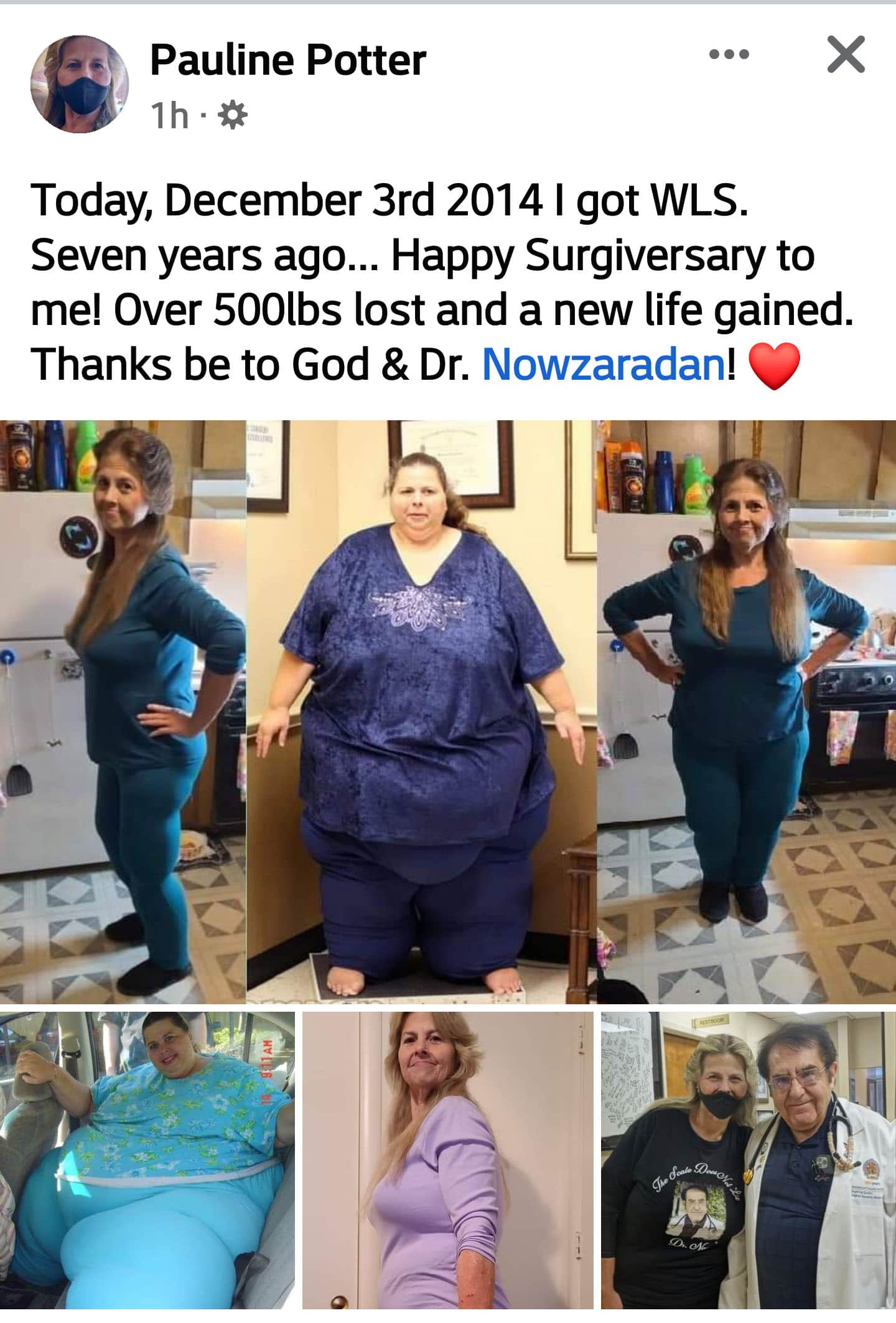 Pauline Potter Celebrates Massive Weight Loss On Special Day Body24building