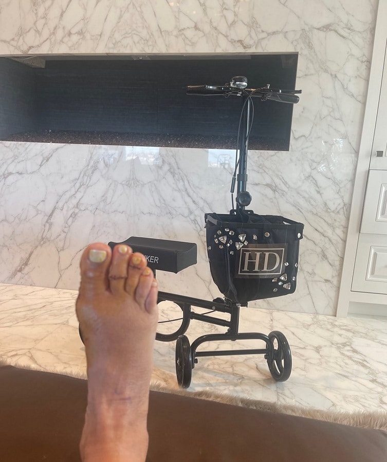 Heather Dubrow's Graphic Surgery Pic [Credit: Heather Dubrow/Instagram]