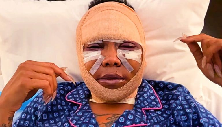 Shock Footage: ‘My Killer Body with K. Michelle’ Shows Graphic Surgical Damage