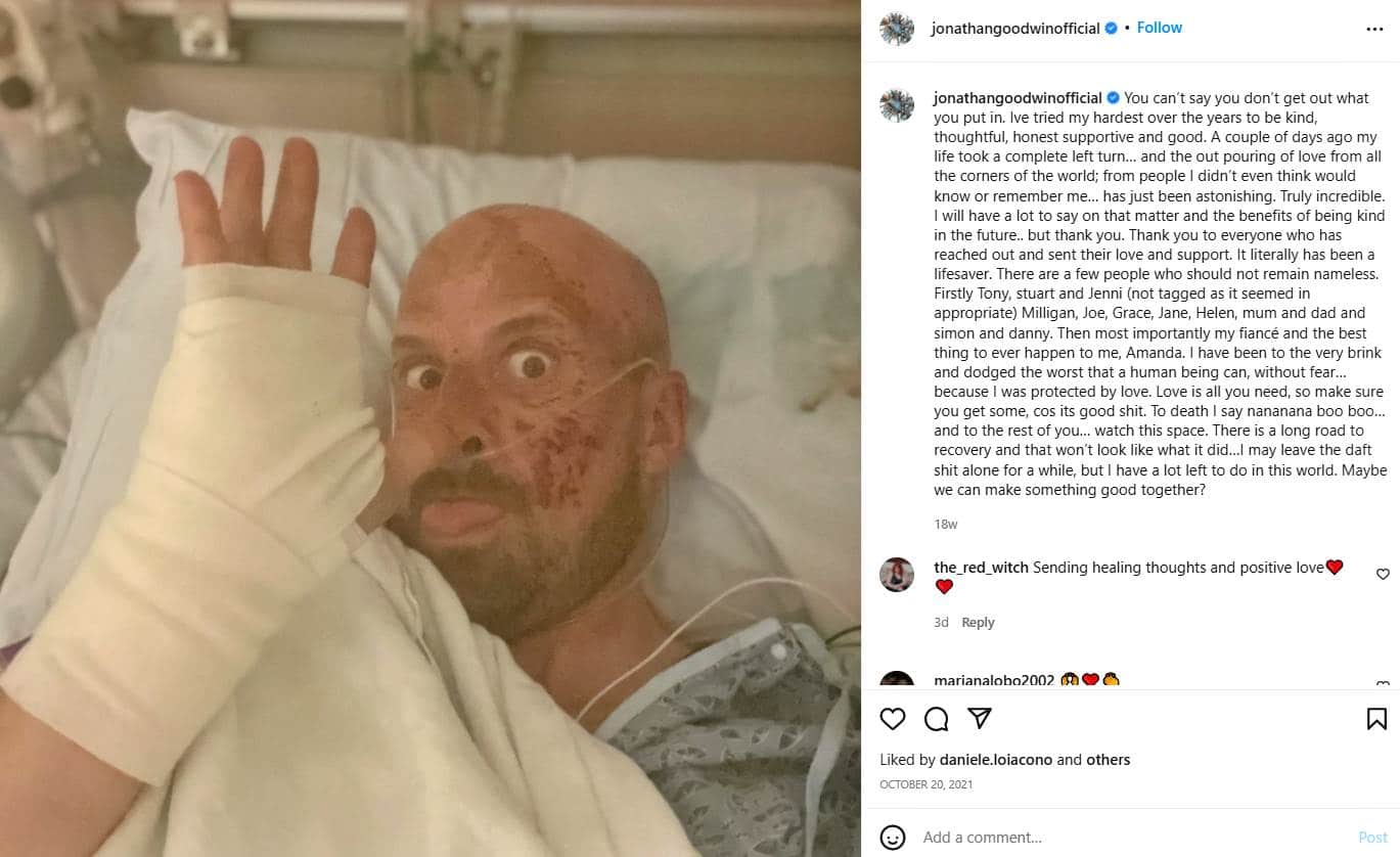 AGT: Extreme stunt man Jonathan Goodwin released from hospital