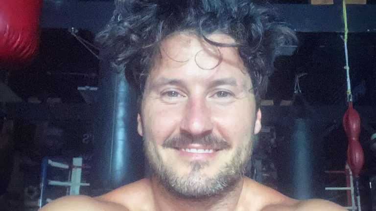 Val Chmerkovskiy Calls Out ‘DWTS’ Castmates Over Silence On Ukraine