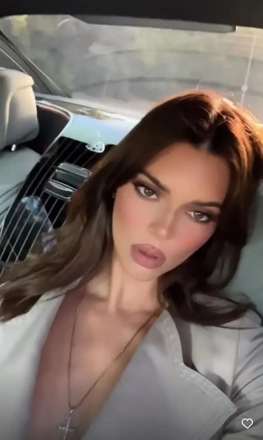 Kendall Jenner Accused Of Lip Fillers [Kendall Jenner | Instagram Stories]