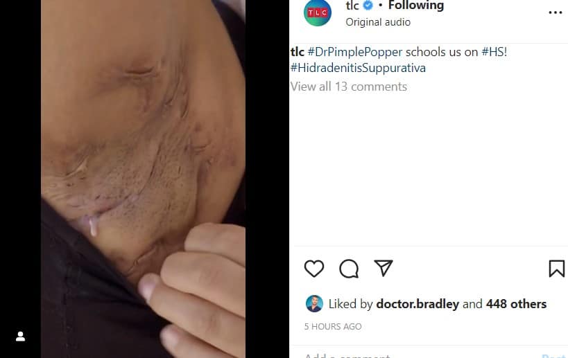 Dr. Pimple Popper from Instagram