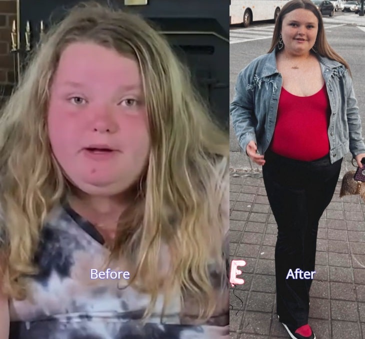 Alana Thompson before and after instagram/youtube