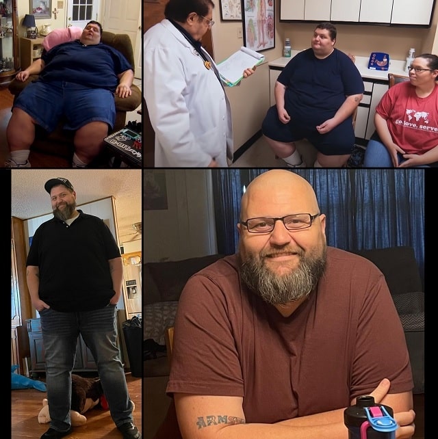 'My 600lb Life' Doug Armstrong SHOCKING Update Amid Surgery
