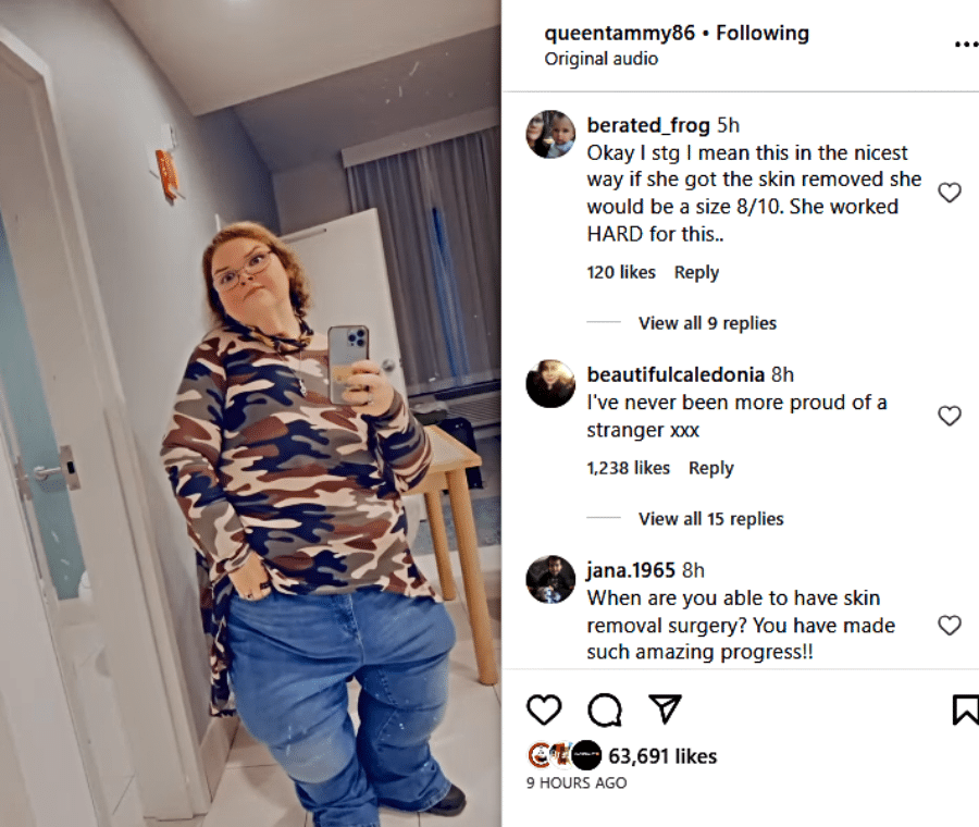 1000-Lb Sisters Fans Want Tammy Slaton's Skin Surgery So Badly