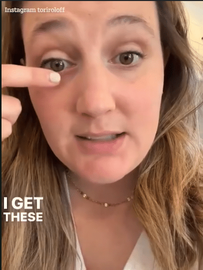 Tori Roloff pointing to stye on her lower eyelid, that may have resulted from her possible mascara allergy.