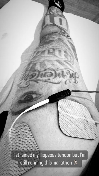 Travis Barker Leg injury - Instagram
