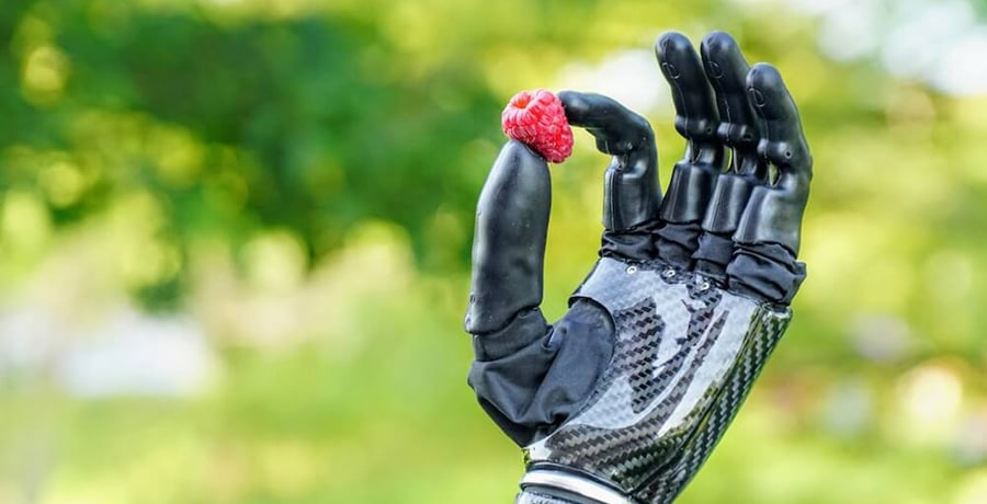 Psyonic bionic hand on Shark Tank