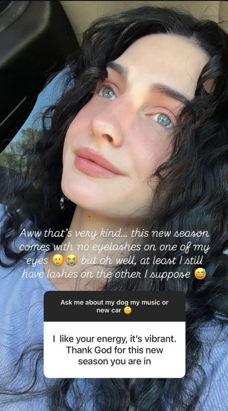 Moriah Plath discusses how her eyelashes are affected by alopecia. - Instagram - Reddit