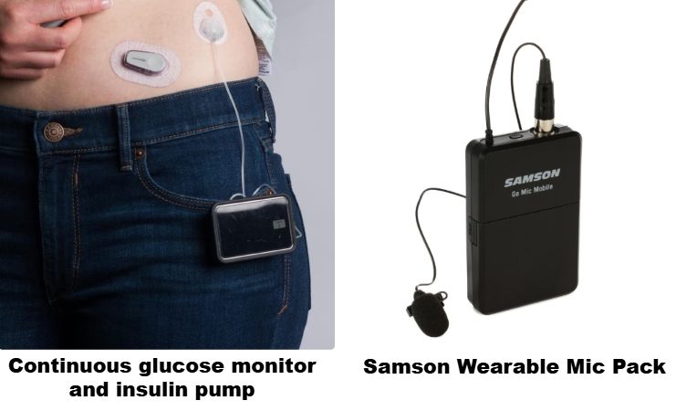 Continuous glucose monitor and insulin pump (Mayo Clinic) compared to Samson mic pack. - Sweetwater.com